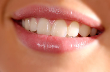 Strong White Teeth - Cosmetic Dentistry